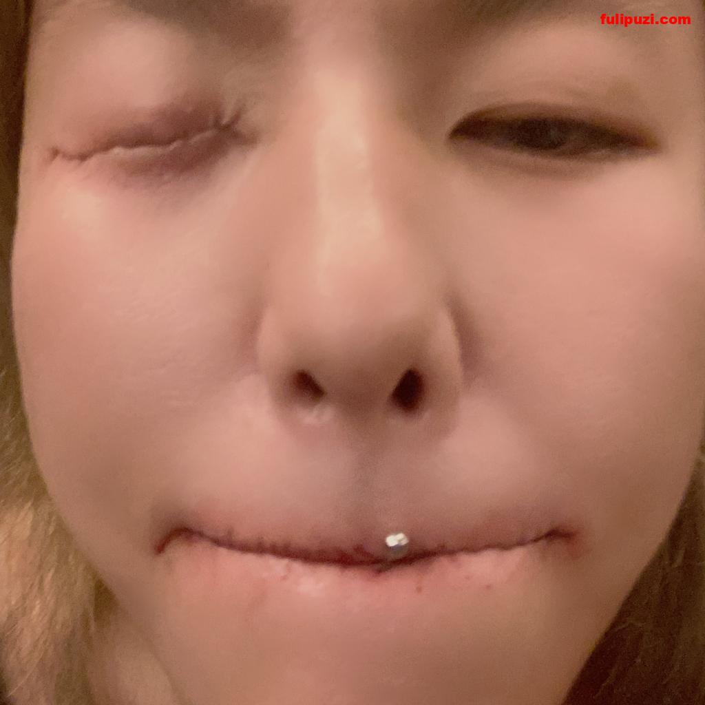 推特猛女【莎莎@shasha474757】超强穿刺缝合调教 缝眼缝嘴缝逼缝奶万物皆可缝【58P+5V/24M】