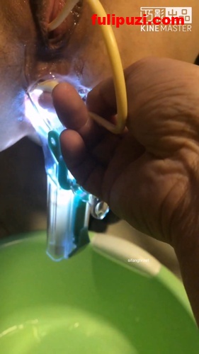 重口阴环女6：变态扩张看子宫灌肠注射灌膀胱【1V/2.34g】